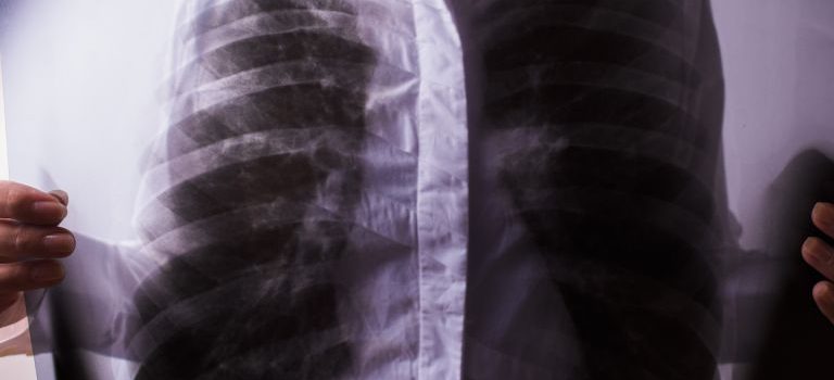 オーストラリアの広大な国土に根ざす最先端の公衆衛生とワクチン接種政策 オーストラリアの広大な国土に根ざす最先端の公衆衛生とワクチン接種政策