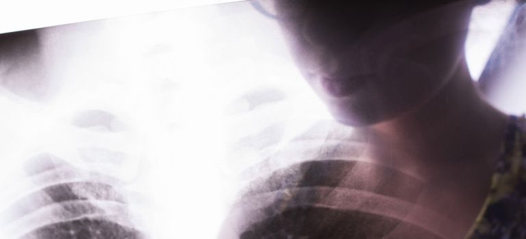 オーストラリアが誇る予防医療とワクチン接種体制の革新と持続的進化